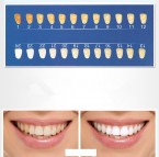 Bieliace pásiky na zuby 3D white