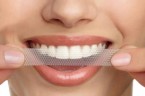 Bieliace pásiky na zuby 3D White, bielenie zubov