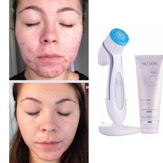 !VYPREDAJ! NuSkin Lumispa pristroj+gel,zlava40%