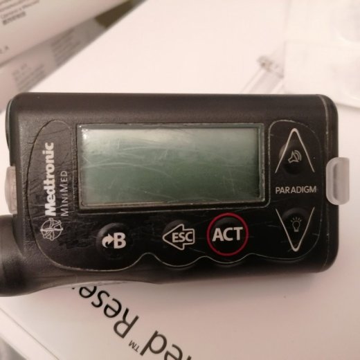 Inzulinova pumpa
